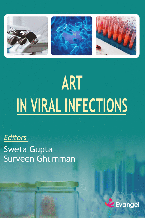 ART In Viral Infections 1st Edition