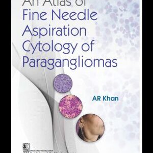 An Atlas of Fine Needle Aspiration Cytology of Paragangliomas 1st Edition