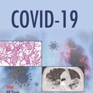 Covid-19 1st Edition