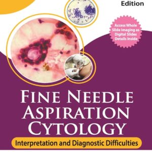 Fine Needle Aspiration Cytology Interpretation and Diagnostic Difficulties 3rd Edition