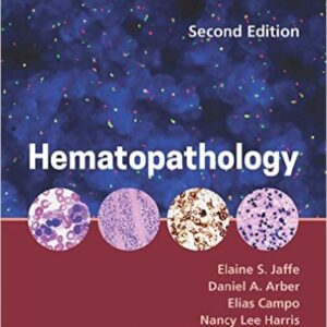 Hematopathology 2nd Edition