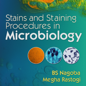 Stains and Staining Procedures in Microbiology 1st Edition