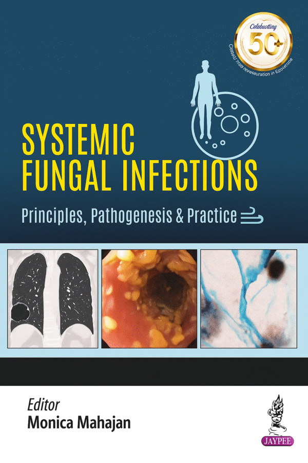 Systemic Fungal Infections 1st Edition