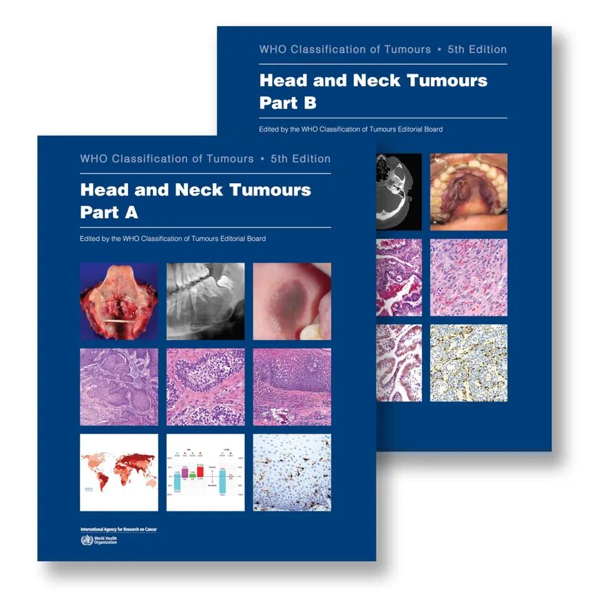 WHO Classification of Tumours Haematolymphoid Tumours
