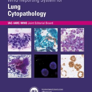 WHO Reporting System for Lymph Node, Spleen, and Thymus Cytopathology 1st Edition