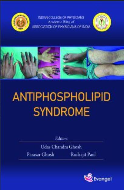 Antiphospholipid Syndrome 1st Edition