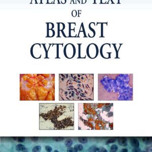 Atlas and Text of Breast Cytology 1st Edition