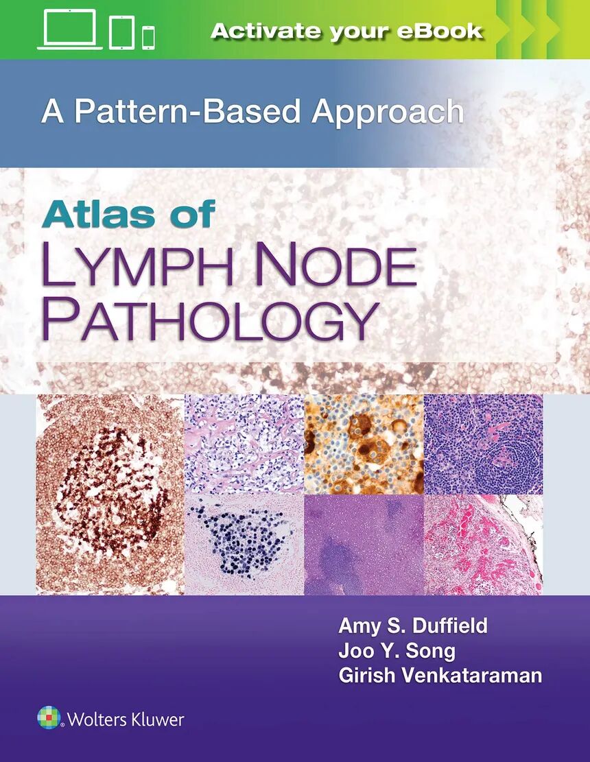 Atlas of Lymph Node Pathology 1st Edition