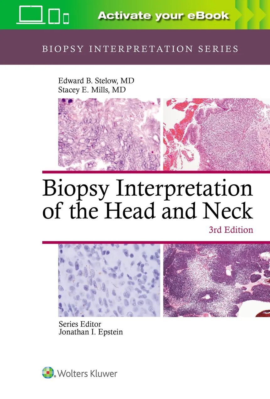 Biopsy Interpretation Of The Head And Neck 3rd Edition
