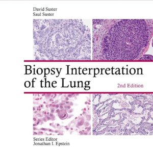 Biopsy Interpretation of the Lung 2nd Edition