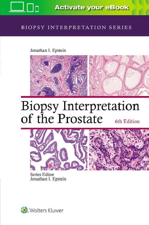 Biopsy Interpretation of the Prostate 6th Edition