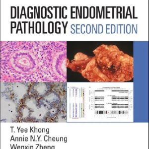 Diagnostic Endometrial Pathology 2nd Edition
