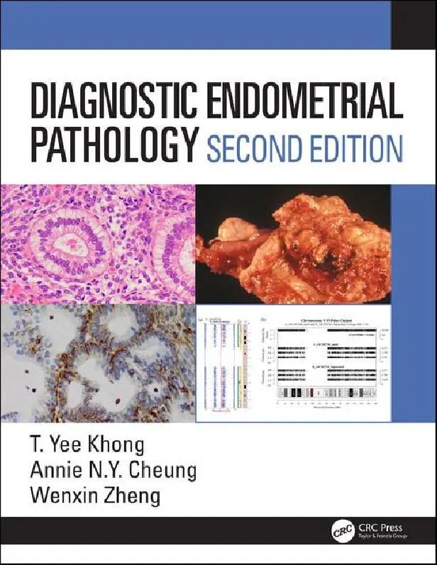 Diagnostic Endometrial Pathology 2nd Edition