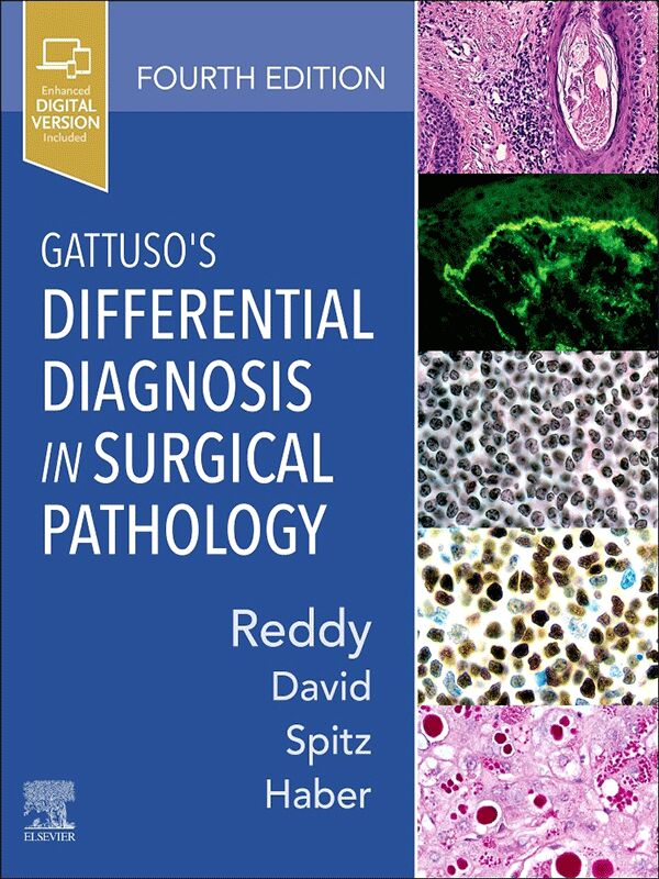 Gattusos Differential Diagnosis in Surgical Pathology 4th Edition