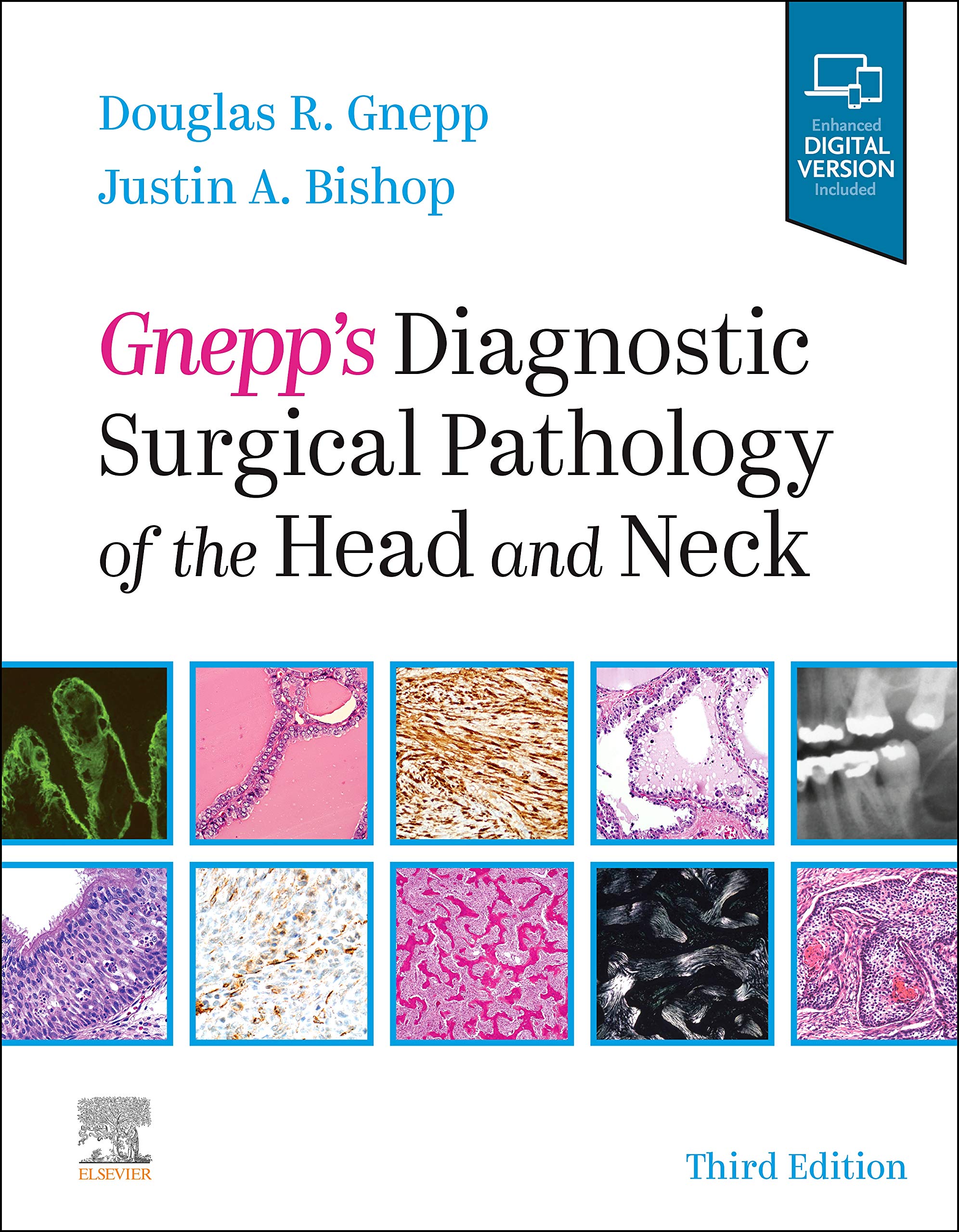 Gnepp's Diagnostic Surgical Pathology of the Head and Neck 3rd Edition