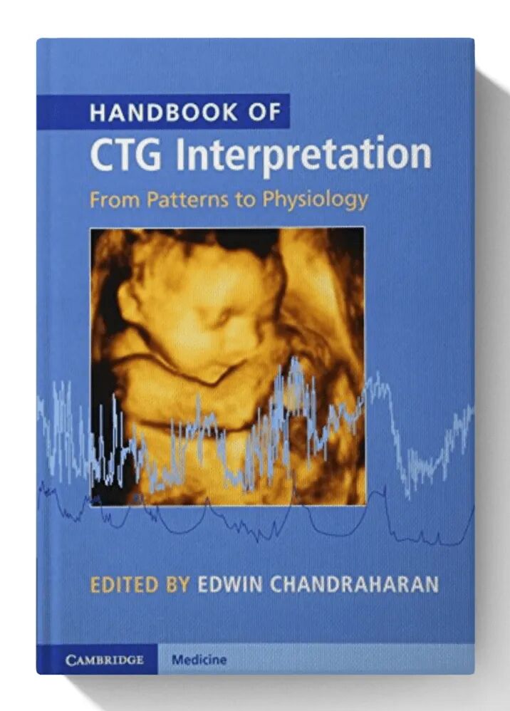 Handbook of CTG Interpretation 1st Edition