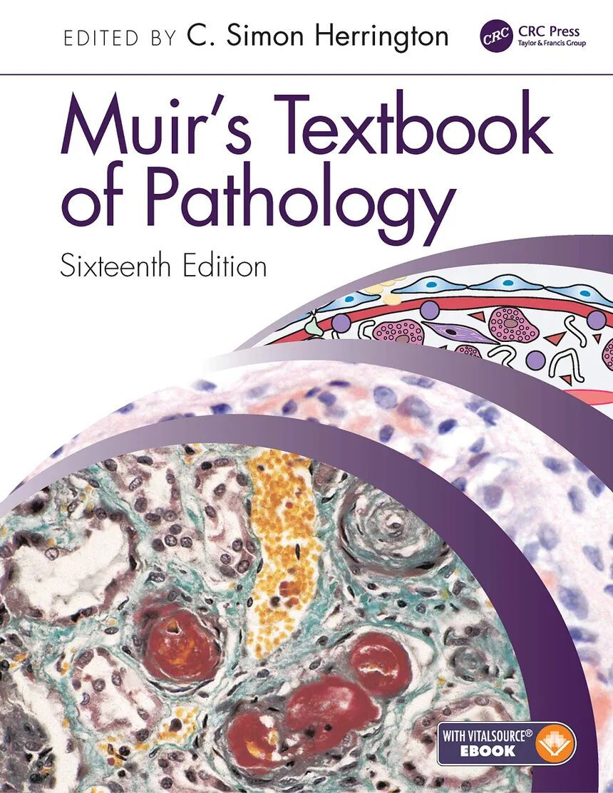 Muirs Textbook Of Pathology 16th Edition