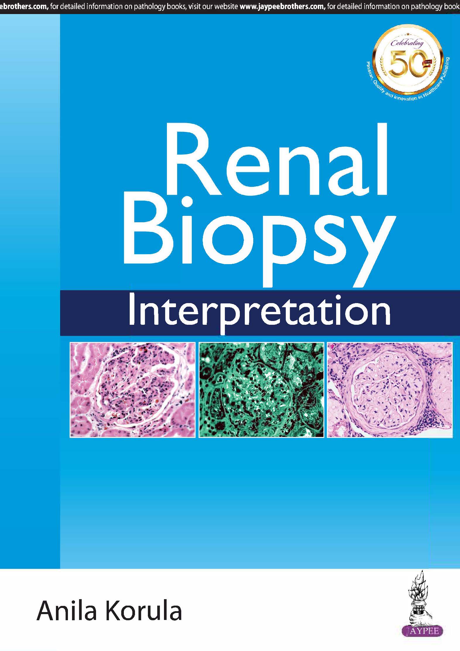 Renal Biopsy Interpretation 1st Edition