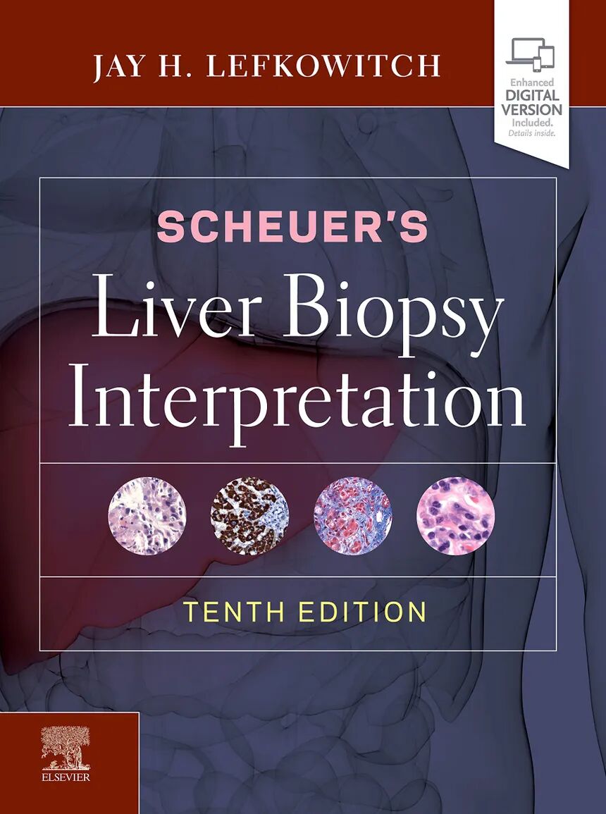 Scheuer's Liver Biopsy Interpretation 10th Edition