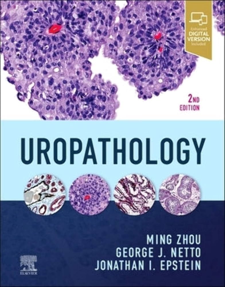 Uropathology 2nd Edition