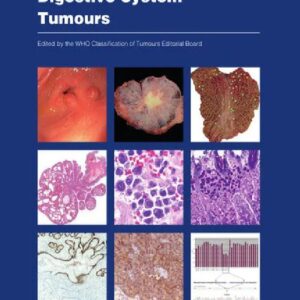WHO Classification of Tumours: Digestive System Tumours 5th Edition