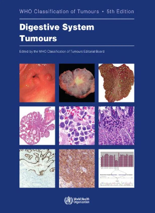 WHO Classification of Tumours: Digestive System Tumours 5th Edition