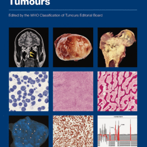 WHO Classification of Tumours: Soft Tissue and Bone Tumours 5th Edition