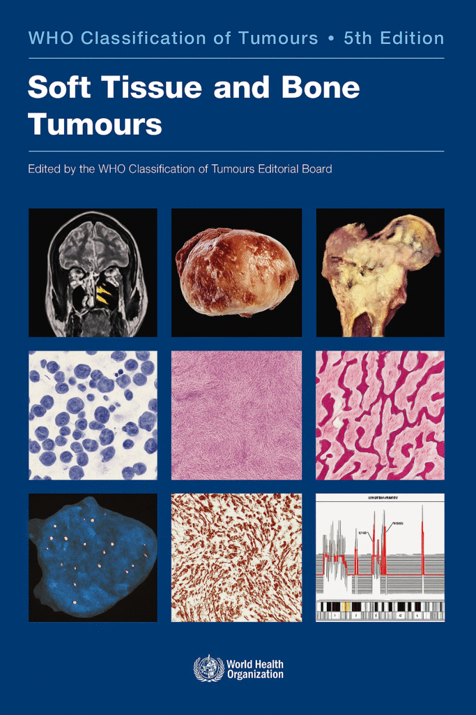 WHO Classification of Tumours: Soft Tissue and Bone Tumours 5th Edition ...