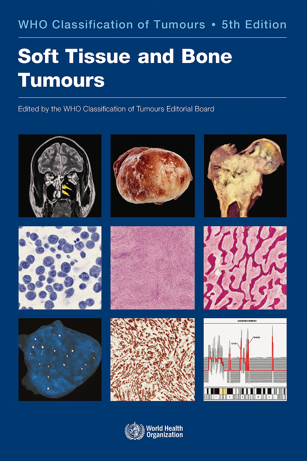 WHO Classification of Tumours: Soft Tissue and Bone Tumours 5th Edition