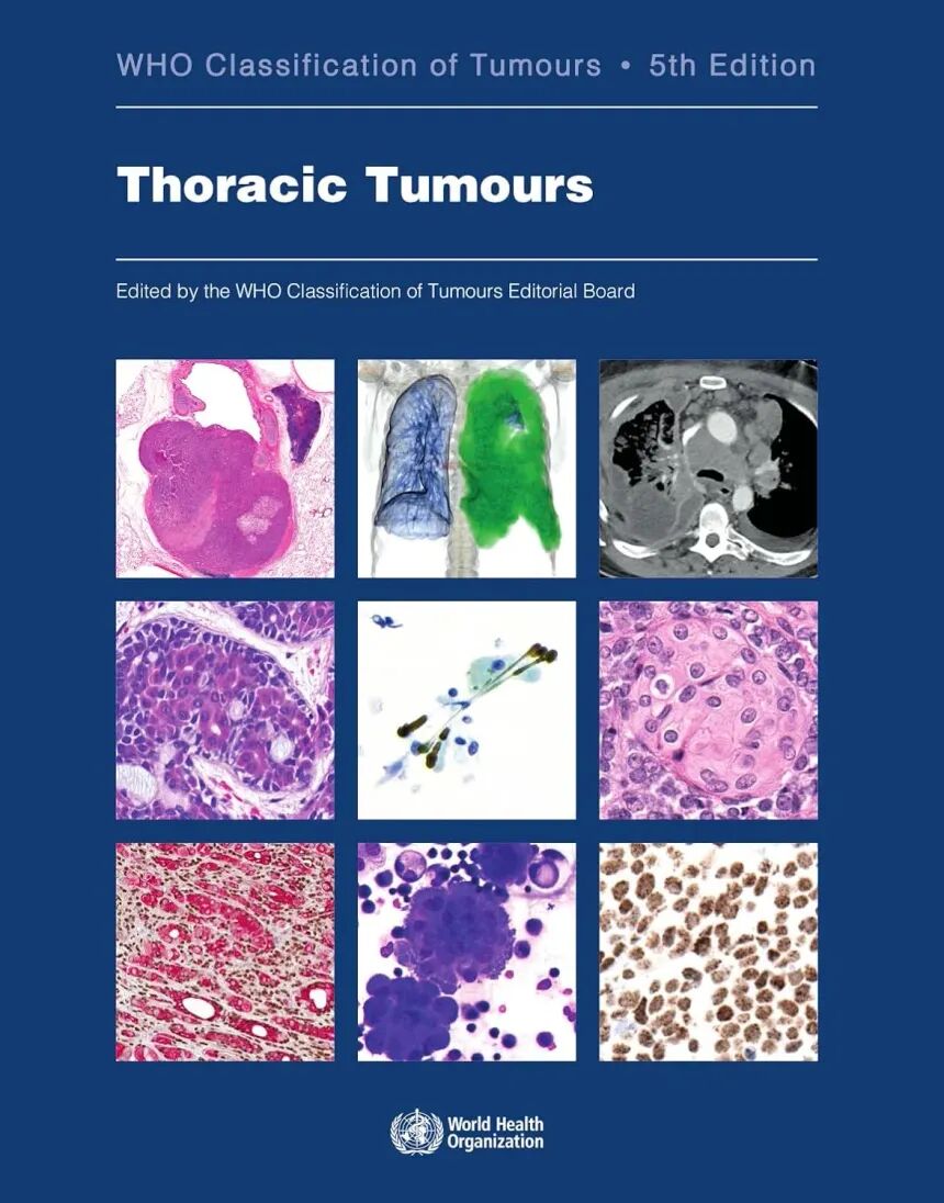 WHO Classification of Tumours: Thoracic Tumours 5th Edition