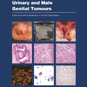 WHO Classification of Tumours : Urinary and Male Genital Tumours 5th Edition