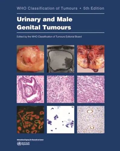 WHO Classification of Tumours : Urinary and Male Genital Tumours 5th Edition