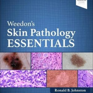 Weedon's Skin Pathology Essentials 3rd Edition