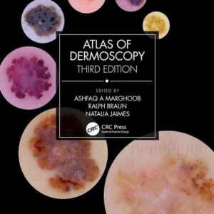 Atlas Of Dermoscopy 3rd Edition
