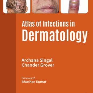 Atlas of Infections in Dermatology 2nd Edition