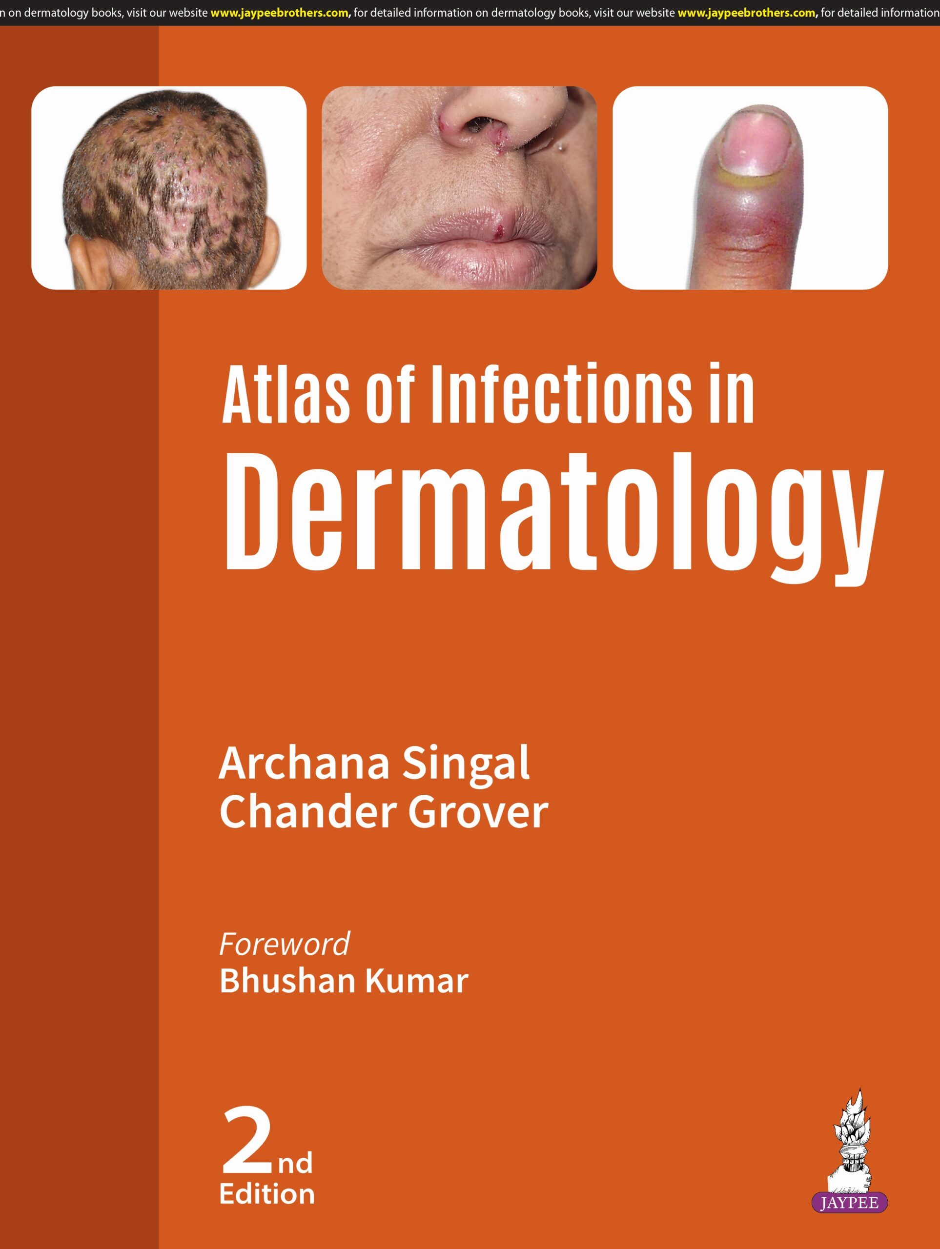 Atlas of Infections in Dermatology 2nd Edition