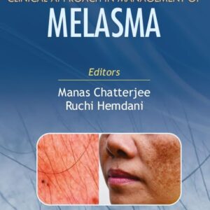 Clinical Approach in Management of Melasma 1st Edition