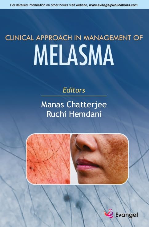 Clinical Approach in Management of Melasma 1st Edition