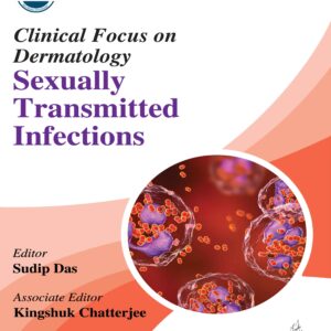Clinical Focus on Dermatology: Sexually Transmitted Infections 1st Edition
