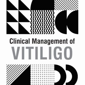 Clinical Management of Vitiligo 1st Edition
