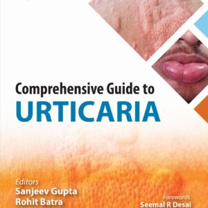 Comprehensive Guide to Urticaria 1st Edition