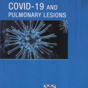 Covid 19 and Pulmonary Lesions 1st Edition