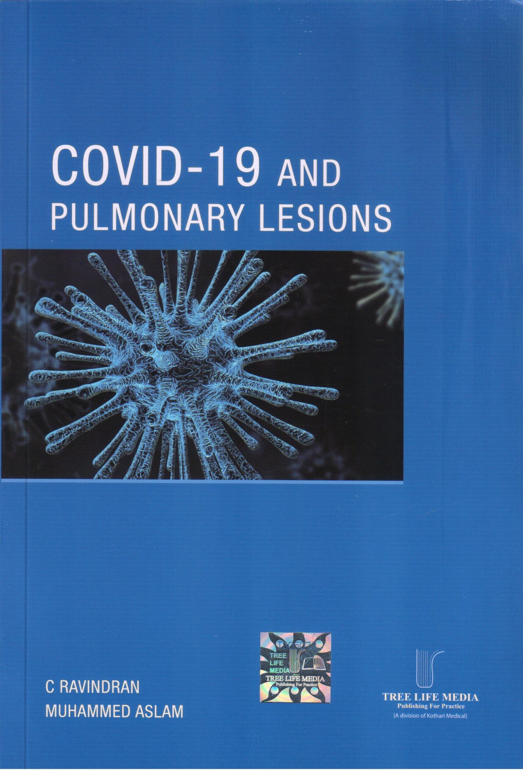 Covid 19 and Pulmonary Lesions 1st Edition