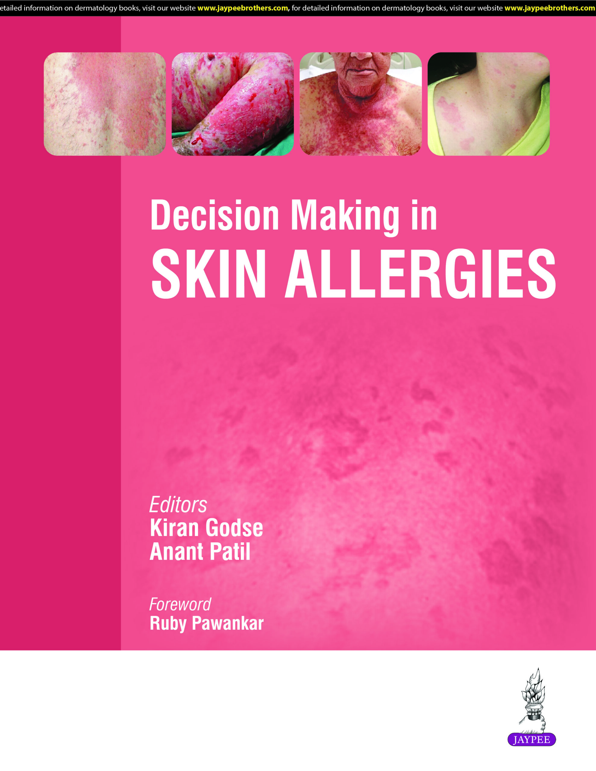 Decision Making in Skin Allergies 1st Edition