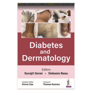 Diabetes and Dermatology 1st Edition