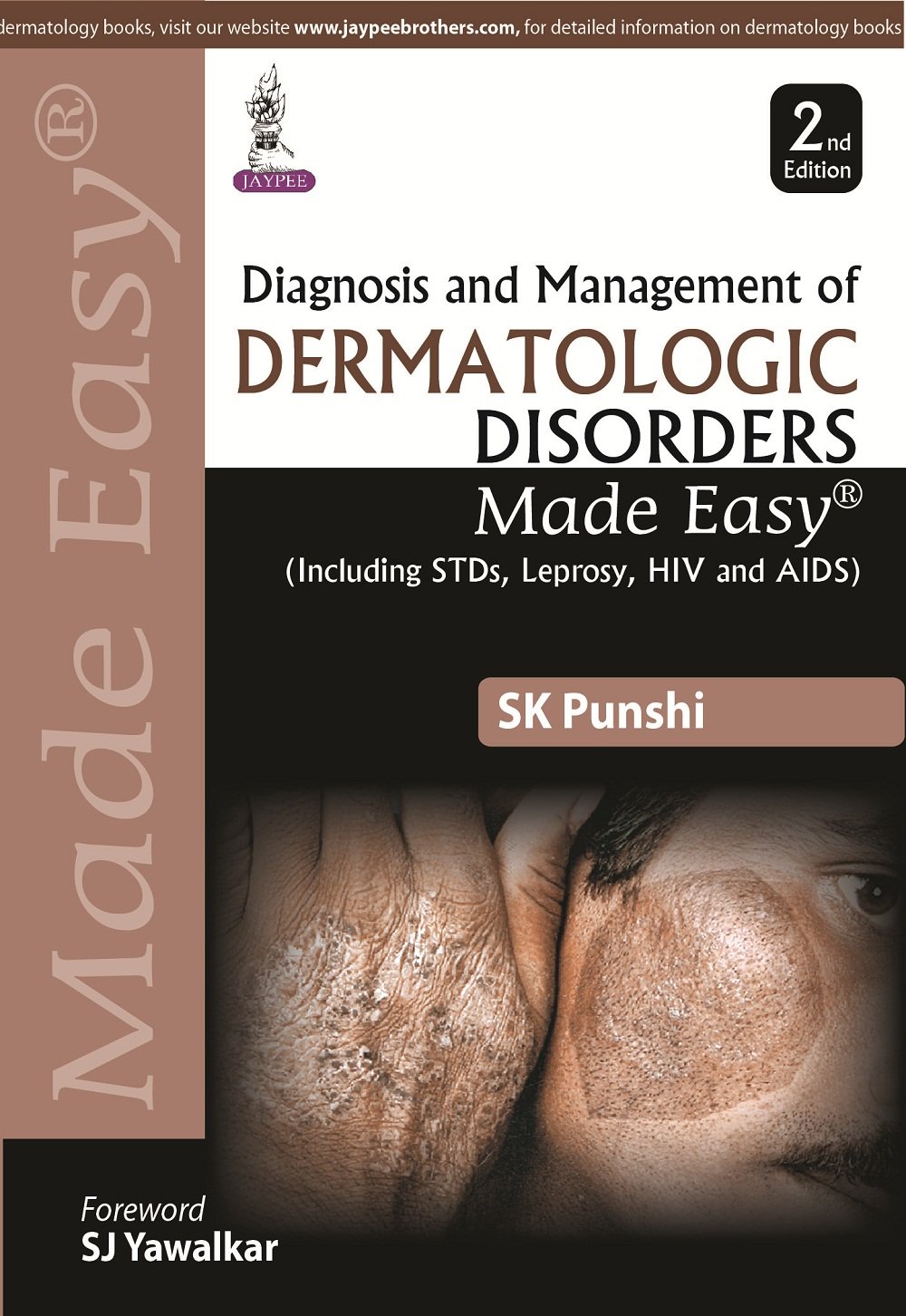 Diagnosis and Management of Dermatologic Disorders Made Easy 2nd Edition