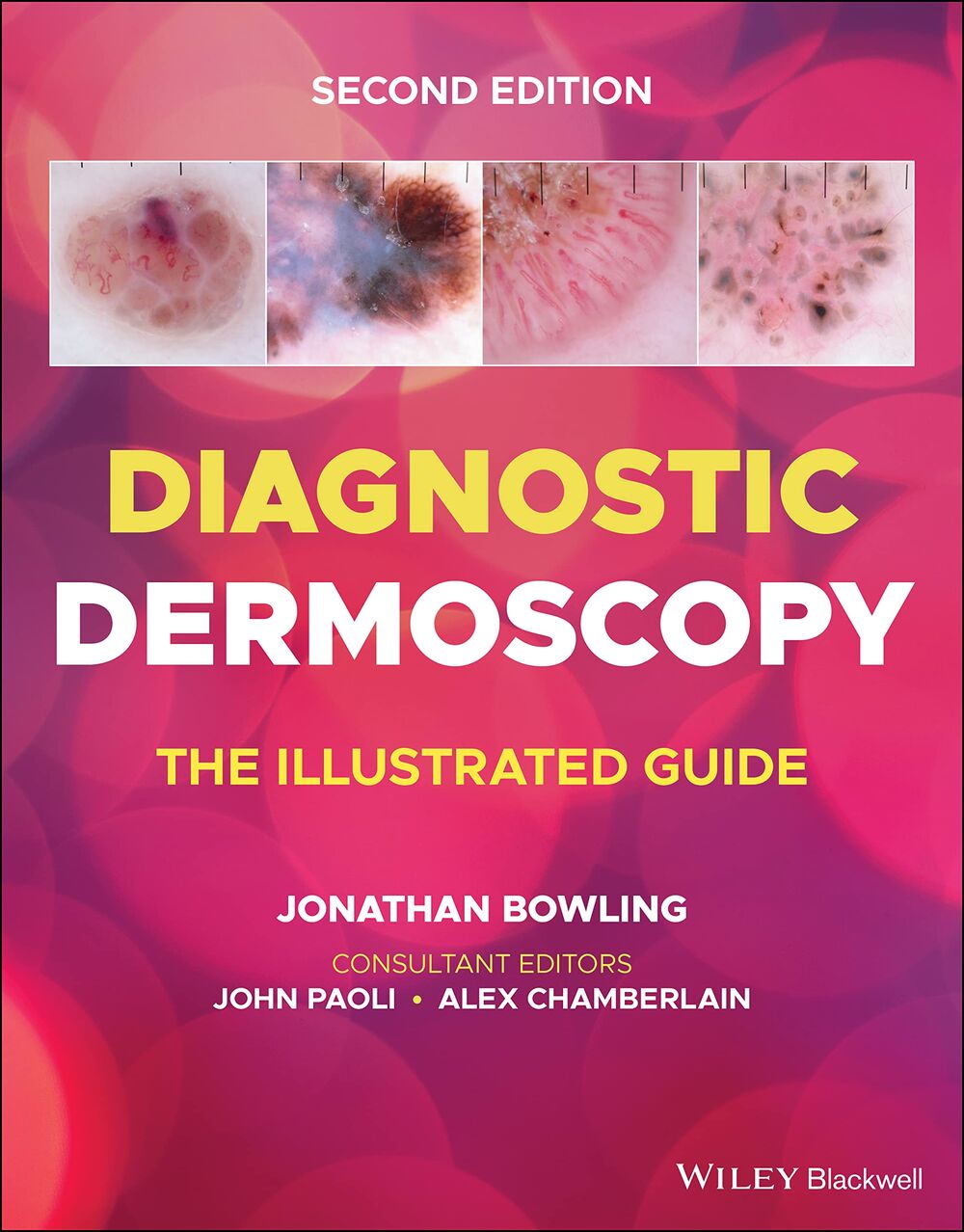 Diagnostic Dermoscopy: The Illustrated Guide 2nd Edition