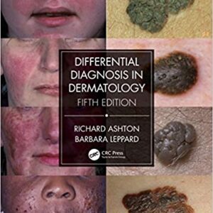 Differential Diagnosis in Dermatology 5th Edition