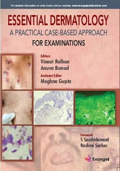 Essential Dermatology 1st Edition