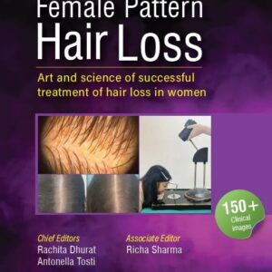 Female Pattern Hair Loss 1st Edition